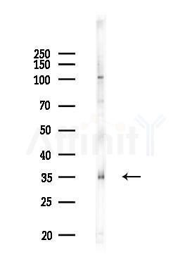 GDF15 Recombinant Rabbit mAb - Western blot analysis of lysates from EC304 cells(LPS,4h treatment), using GDF15 Rabbit mAb at 1/1000 dilution.