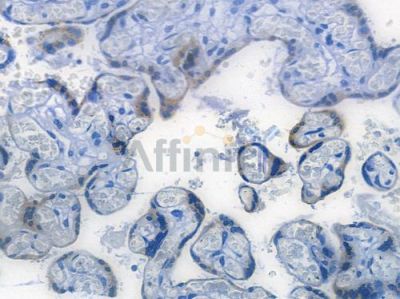 GDF15 Recombinant Rabbit mAb - BF3797 at 1/100 staining human normal placenta tissue by IHC-P.