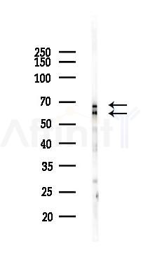 PDPK1 Recombinant Rabbit mAb - Western blot analysis of lysates from Rat spleen, using PDPK1 Recombinant Rabbit mAb at 1/1000 dilution.