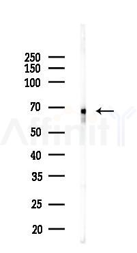 PDPK1 Recombinant Rabbit mAb - Western blot analysis of lysates from Hela cells(LPS,4h treatment), using PDPK1 Recombinant Rabbit mAb at 1/1000 dilution.