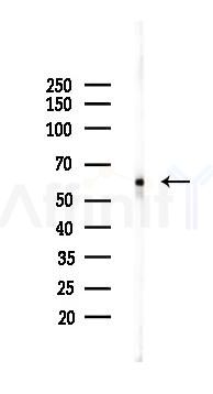 PDPK1 Recombinant Rabbit mAb - Western blot analysis of lysates from HUVEC cells(LPS,4h treatment), using PDPK1 Recombinant Rabbit mAb at 1/1000 dilution.
