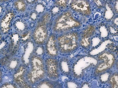 PDPK1 Recombinant Rabbit mAb - BF3800 at 1/100 staining human normal kidney tissue by IHC-P.