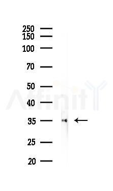 Annexin A1 Recombinant Rabbit mAb - Western blot analysis of lysates from Mouse lung, using Annexin A1 Recombinant Rabbit mAb at 1/1000 dilution.