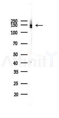 Neurofilament heavy polypeptide Recombinant Rabbit mAb - Western blot analysis of lysates from A2780 cells(LPS 4h treatment), using Neurofilament heavy polypeptide Recombinant Rabbit mAb at 1/1000 dilution.