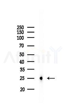 CD227/MUC1 Recombinant Rabbit mAb - Western blot analysis of lysates from COLO205 cells(LPS, 4h treatment), using MUC1 Recombinant Rabbit mAb at 1/1000 dilution.