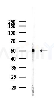 PTP1B Recombinant Rabbit mAb - Western blot analysis of lysates from EC304 cells(LPS, 4h treatment), using PTPN1 Recombinant Rabbit mAb at 1/1000 dilution.