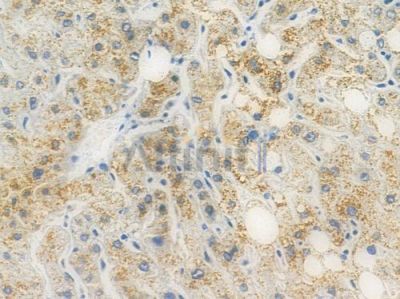 PTP1B Recombinant Rabbit mAb - BF3807 at 1/100 staining human normal liver tissue by IHC-P.