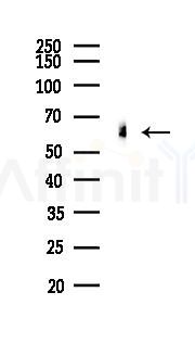 HNF1 beta Recombinant Rabbit mAb - Western blot analysis of lysates from EC304 cells(LPS, 4h treatment), using HNF-1B Recombinant Rabbit mAb at 1/1000 dilution.