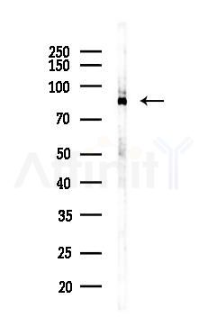 Ataxin 1 Recombinant Rabbit mAb - Western blot analysis of lysates from Mouse lung, using Ataxin 1 Recombinant Rabbit mAb at 1/1000 dilution.