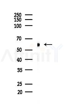 SESN2 Recombinant Rabbit mAb - Western blot analysis of lysates from COLO205 cells(heat-shock, 45min treatment), using SESN2 Recombinant Rabbit mAb at 1/1000 dilution.