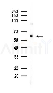 SESN2 Recombinant Rabbit mAb - Western blot analysis of lysates from B16F10-LUC cells(LPS, 4h treatment), using SESN2 Recombinant Rabbit mAb at 1/1000 dilution.
