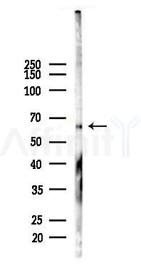 FOXO4 Recombinant Rabbit mAb - Western blot analysis of lysates from A2780 cells(starvation 24h treatment), using FOXO4 Recombinant Rabbit mAb at 1/1000 dilution.
