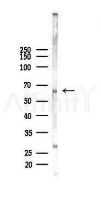 FOXO4 Recombinant Rabbit mAb - Western blot analysis of lysates from COLO205 cells(UV 30min treatment), using FOXO4 Recombinant Rabbit mAb at 1/1000 dilution.