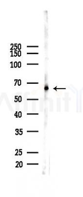 FOXO4 Recombinant Rabbit mAb - Western blot analysis of lysates from PC12 cells(LPS 4h treatment), using FOXO4 Recombinant Rabbit mAb at 1/1000 dilution.