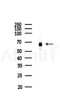 SHP2 Recombinant Rabbit mAb - Western blot analysis of lysates from COLO205 cells(heat-shock,45min treatment), using SHP2 Recombinant Rabbit mAb at 1/1000 dilution.