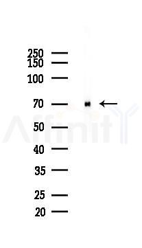 SHP2 Recombinant Rabbit mAb - Western blot analysis of lysates from Rat muscle, using SHP2 Recombinant Rabbit mAb at 1/1000 dilution.