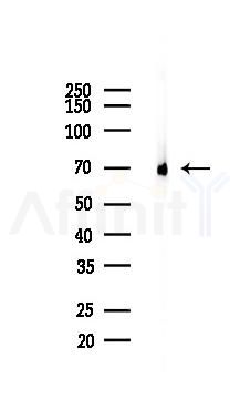 SHP2 Recombinant Rabbit mAb - Western blot analysis of lysates from A375 cells(heat-shock,45min treatment), using SHP2 Recombinant Rabbit mAb at 1/1000 dilution.