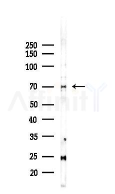 TNR11 Recombinant Rabbit mAb - Western blot analysis of lysates from EC304 cells(heat-shock,45min treatment), using RANK Recombinant Rabbit mAb at 1/1000 dilution.