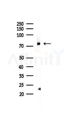 TNR11 Recombinant Rabbit mAb - Western blot analysis of lysates from Rat liver, using RANK Recombinant Rabbit mAb at 1/1000 dilution.