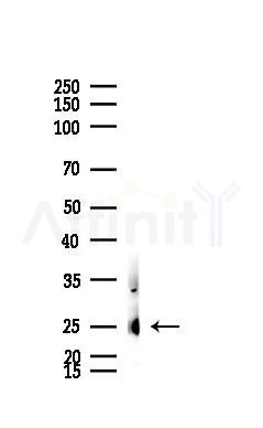 C1QC Recombinant Rabbit mAb - Western blot analysis of lysates from Mouse testis, using C1QC Recombinant Rabbit mAb at 1/1000 dilution.