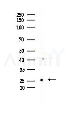 C1QC Recombinant Rabbit mAb - Western blot analysis of lysates from Rat liver, using C1QG Recombinant Rabbit mAb at 1/1000 dilution.