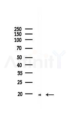 SCGB1A1 Recombinant Rabbit mAb - Western blot analysis of lysates from COLO205 cells(LPS, 4h treatment), using Uteroglobin Recombinant Rabbit mAb at 1/1000 dilution.