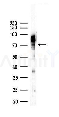 GLB1 Recombinant Rabbit mAb - Western blot analysis of lysates from Hela cells(LPS,4h treatment), using GLB1 Recombinant Rabbit mAb at 1/1000 dilution.