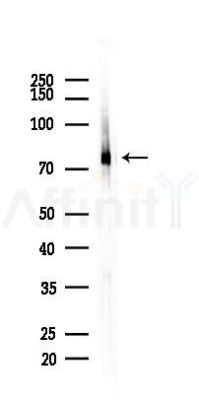 GLB1 Recombinant Rabbit mAb - Western blot analysis of lysates from 293 cells(heat-shock,45min treatment), using GLB1 Recombinant Rabbit mAb at 1/1000 dilution.