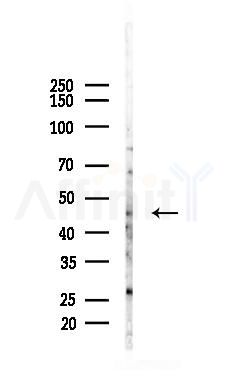 SERPINH1 Recombinant Rabbit mAb - Western blot analysis of lysates from A2780 cells(UV 30min treatment), using Hsp47 Recombinant Rabbit mAb at 1/1000 dilution.