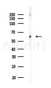 BIRC2 Recombinant Rabbit mAb - Western blot analysis of lysates from Hela cells(LPS,4h treatment), using cIAP1 Recombinant Rabbit mAb at 1/1000 dilution.