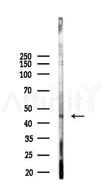 ADFP Recombinant Rabbit mAb - Western blot analysis of lysates from Hela cells(LPS, 4h treatment), using ADFP Recombinant Rabbit mAb at 1/1000 dilution.
