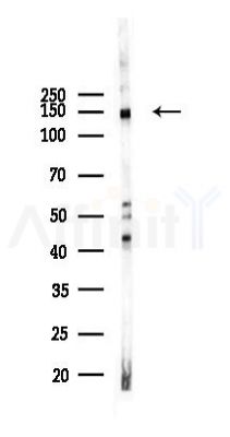 HDAC9 Recombinant Rabbit mAb - Western blot analysis of lysates from Hela cells(LPS,4h treatment), using HDAC9 Recombinant Rabbit mAb at 1/1000 dilution.