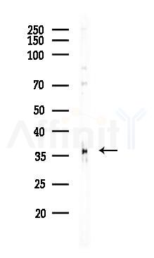 OGG1 Recombinant Rabbit mAb - Western blot analysis of lysates from A375 cells(heat-shock,45min treatment), using Ogg1 Recombinant Rabbit mAb at 1/1000 dilution.