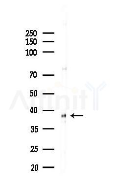 OGG1 Recombinant Rabbit mAb - Western blot analysis of lysates from EC304 cells(heat-shock,45min treatment), using Ogg1 Recombinant Rabbit mAb at 1/1000 dilution.
