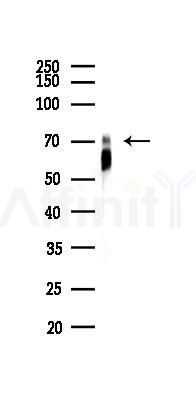 TFE3 Recombinant Rabbit mAb - Western blot analysis of lysates from Hela cells(LPS,4h treatment), using TFE3 Recombinant Rabbit mAb at 1/1000 dilution.