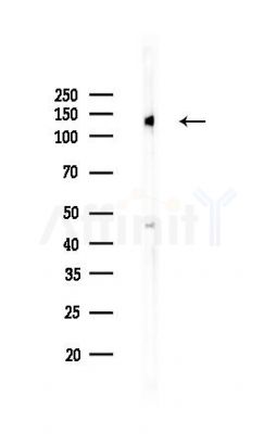 EphB2 Recombinant Rabbit mAb - Western blot analysis of lysates from Hela cells(LPS,4h treatment), using EphB2 Recombinant Rabbit mAb at 1/1000 dilution.