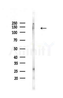 EphB2 Recombinant Rabbit mAb - Western blot analysis of lysates from Rat heart, using EphB2 Recombinant Rabbit mAb at 1/1000 dilution.