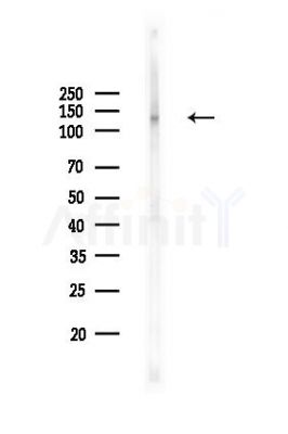 EphB2 Recombinant Rabbit mAb - Western blot analysis of lysates from B16F10-LUC cells(LPS,4h treatment), using EphB2 Recombinant Rabbit mAb at 1/1000 dilution.