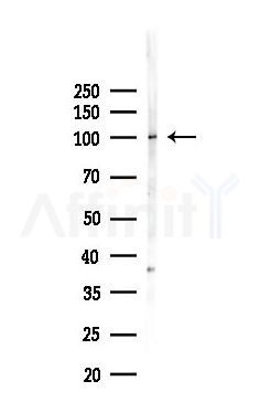 ABCG1 Recombinant Rabbit mAb - Western blot analysis of lysates from Hela cells(heat-shock,45min treatment), using ABCG1 Recombinant Rabbit mAb at 1/1000 dilution.