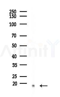 HSP10 Recombinant Rabbit mAb - Western blot analysis of lysates from A2780 cells(UV 30min treatment), using Cpn10 Recombinant Rabbit mAb at 1/1000 dilution.