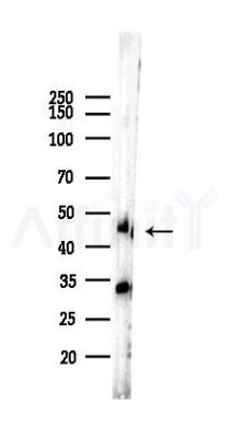 NDRG1 Recombinant Rabbit mAb - Western blot analysis of lysates from B16F10-LUC cells(LPS,4h treatment), using NDRG1 Rabbit mAb at 1/1000 dilution.