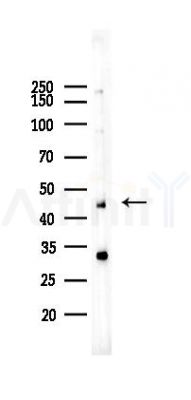 NDRG1 Recombinant Rabbit mAb - Western blot analysis of lysates from HepG2 cells(heat-shock,45min treatment), using NDRG1 Rabbit mAb at 1/1000 dilution.