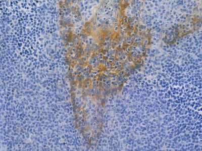 NDRG1 Recombinant Rabbit mAb - BF3848 at 1/100 staining human normal tonsil tissue by IHC-P.