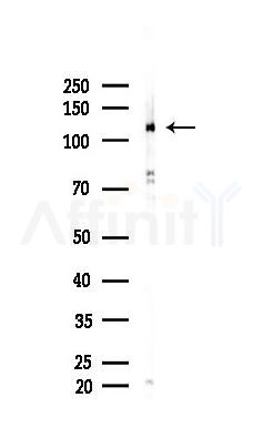 TLR8 Recombinant Rabbit mAb - Western blot analysis of lysates from 293 cells(heat-shock,45min treatment), using TLR8 Recombinant Rabbit mAb at 1/1000 dilution.