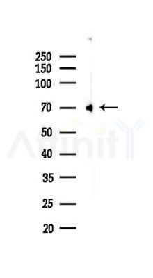 AIF Recombinant Rabbit mAb - Western blot analysis of lysates from Rat lung, using AIF Recombinant Rabbit mAb at 1/1000 dilution.