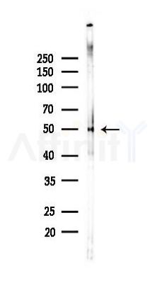 PLAU Recombinant Rabbit mAb - Western blot analysis of lysates from HUVEC cells(LPS,4h treatment), using Urokinase Recombinant Rabbit mAb at 1/1000 dilution.