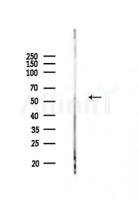 n-Myc Recombinant Rabbit mAb - Western blot analysis of lysates from Rat lung, using n-Myc Recombinant Rabbit mAb at 1/1000 dilution.