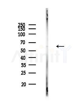 n-Myc Recombinant Rabbit mAb - Western blot analysis of lysates from EC304 cells(starvation 24h treatment), using n-Myc Recombinant Rabbit mAb at 1/1000 dilution.