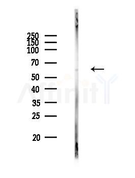 n-Myc Recombinant Rabbit mAb - Western blot analysis of lysates from RAW264.