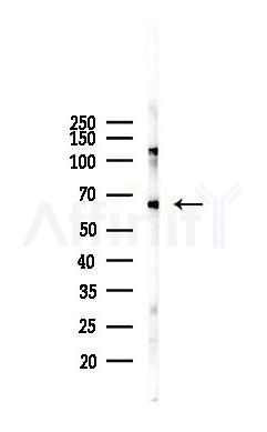 HLA-DPB1 Recombinant Rabbit mAb - Western blot analysis of lysates from Mouse heart, using MHC Class II beta Recombinant Rabbit mAb at 1/1000 dilution.